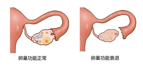 武汉试管婴儿全流程详解：从建档到移植的步骤与时间安排