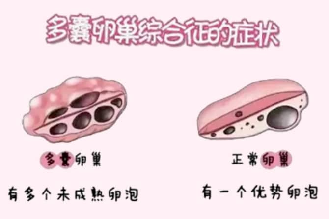 同济医院能借卵生子吗？国内正规供卵的条件限制与政策解读
